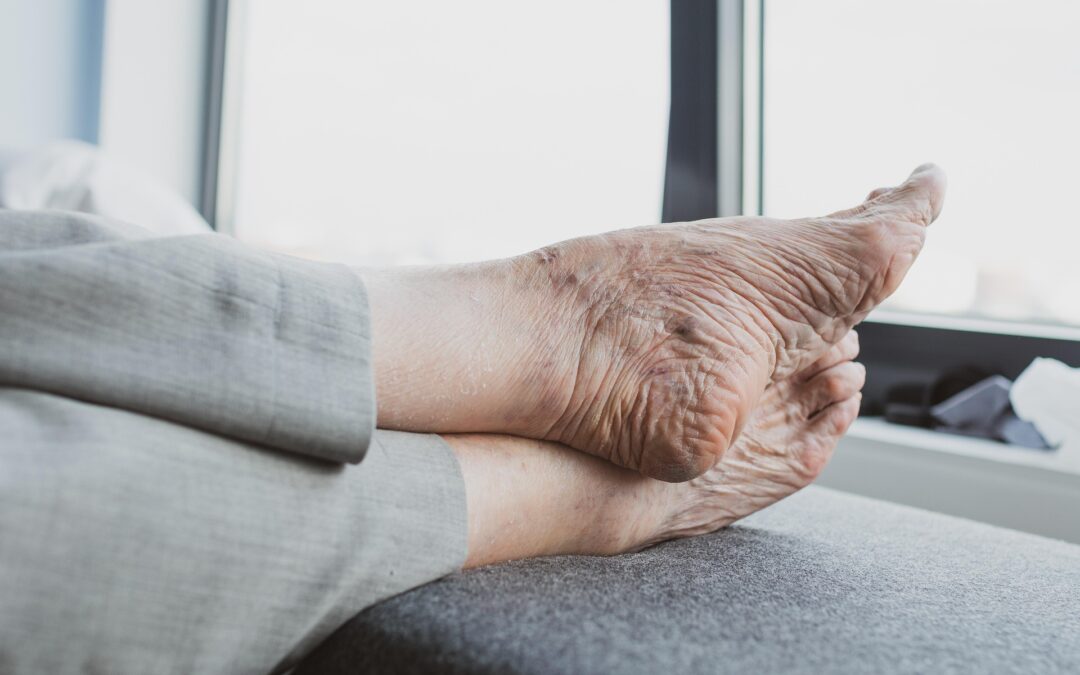 Fraser sought help for his mother Elisabeth’s foot ulcers
